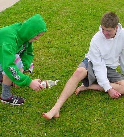 treating jellyfish sting with vinegar
