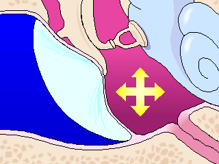 ear reverse block